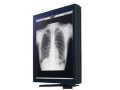 EIZO RadiForce G33
