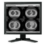 EIZO RadiForce G11