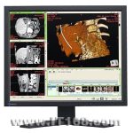 EIZO RadiForce R12