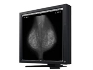 EIZO RadiForce G51