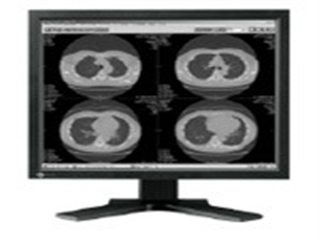 EIZO RadiForce G11