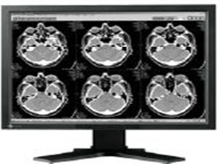 EIZO RadiForce G21